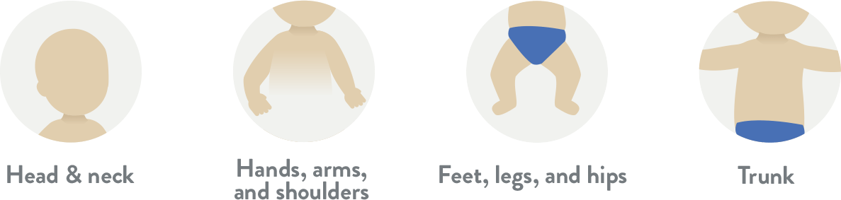 8 motor milestones scored in Hammersmith Infant Neurological Examination (HINE) Section 2